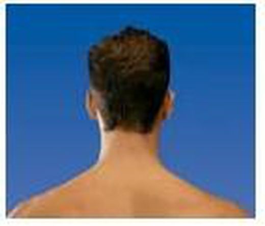 Collarines inmovilizadores