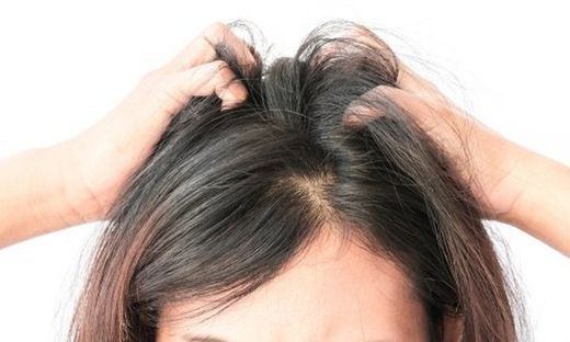 Tratamiento irritación capilar
