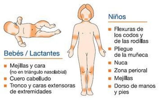 Tratamiento piel atópica para bebés