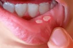 afterapid colutorio 125ml