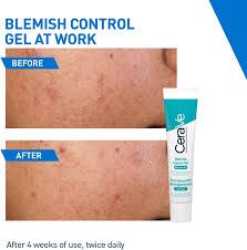 cerave gel blemish control 40ml