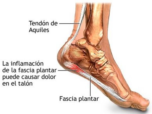 Ortesis Para El Tratamiento Fascitis Plantar Orliman REF: FP01