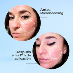 Pack Segle Skin Factor