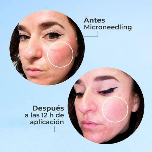 Pack Segle Skin Factor